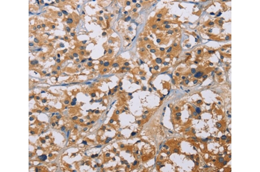 Immunohistochemistry - NME5 Antibody from Signalway Antibody (35842) - Antibodies.com