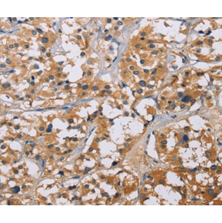 Immunohistochemistry - NME5 Antibody from Signalway Antibody (35842) - Antibodies.com