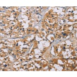 Immunohistochemistry - NME5 Antibody from Signalway Antibody (35842) - Antibodies.com