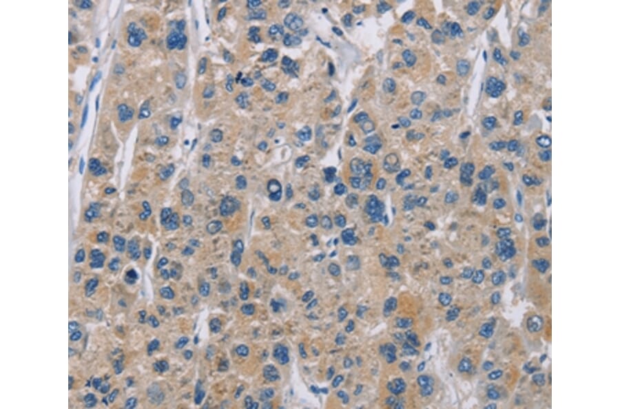Immunohistochemistry - NME5 Antibody from Signalway Antibody (35842) - Antibodies.com