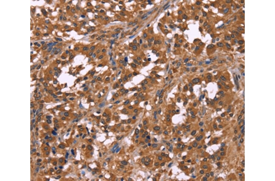 Immunohistochemistry - NOS2 Antibody from Signalway Antibody (35843) - Antibodies.com