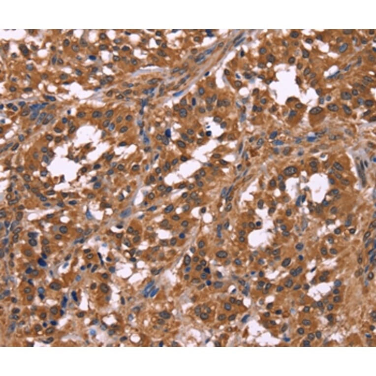 Immunohistochemistry - NOS2 Antibody from Signalway Antibody (35843) - Antibodies.com