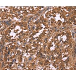 Immunohistochemistry - NOS2 Antibody from Signalway Antibody (35843) - Antibodies.com