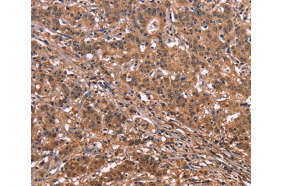 Immunohistochemistry - NOS2 Antibody from Signalway Antibody (35843) - Antibodies.com