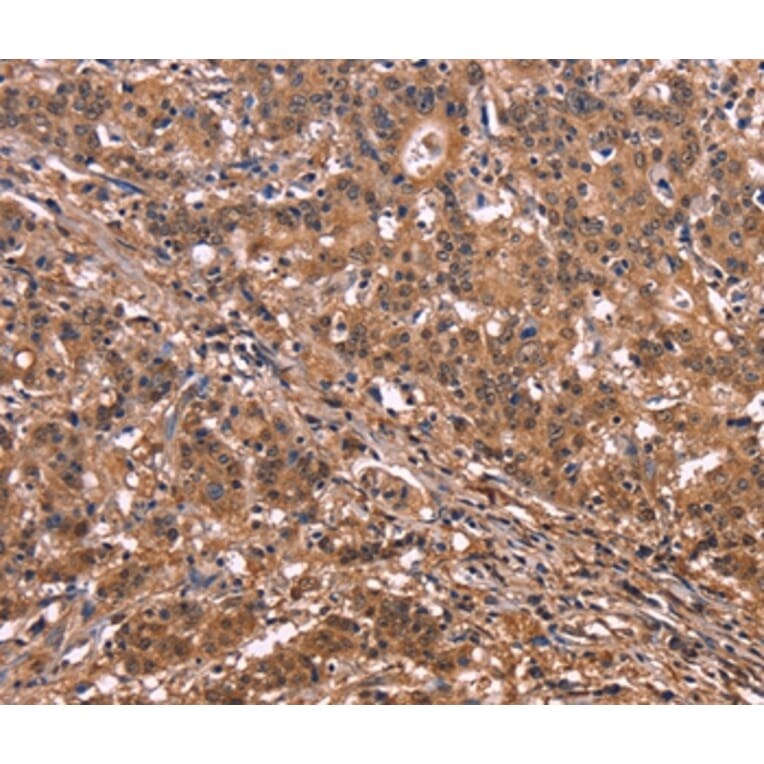 Immunohistochemistry - NOS2 Antibody from Signalway Antibody (35843) - Antibodies.com