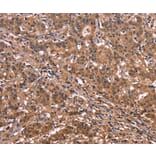 Immunohistochemistry - NOS2 Antibody from Signalway Antibody (35843) - Antibodies.com