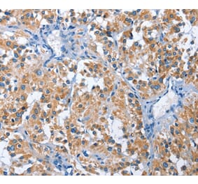 Immunohistochemistry - PAK6 Antibody from Signalway Antibody (35865) - Antibodies.com