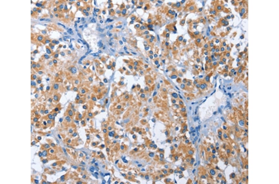 Immunohistochemistry - PAK6 Antibody from Signalway Antibody (35865) - Antibodies.com