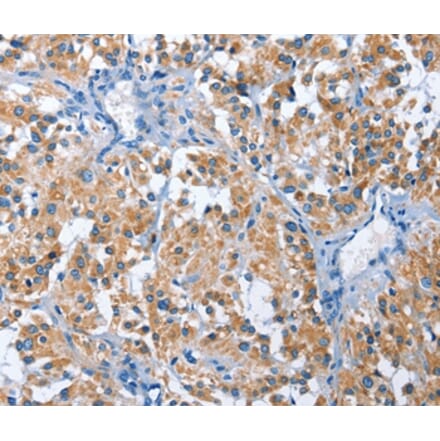 Immunohistochemistry - PAK6 Antibody from Signalway Antibody (35865) - Antibodies.com