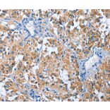 Immunohistochemistry - PAK6 Antibody from Signalway Antibody (35865) - Antibodies.com