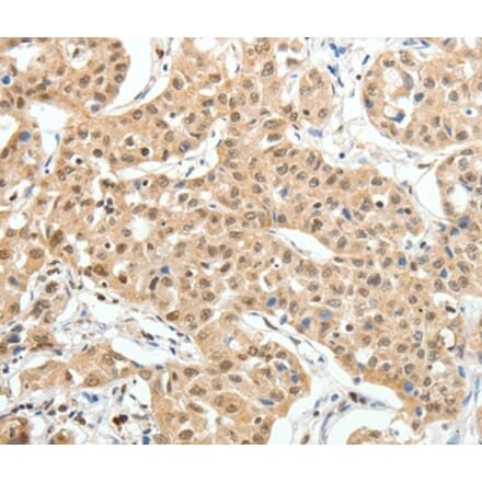Immunohistochemistry - PAX7 Antibody from Signalway Antibody (35869) - Antibodies.com