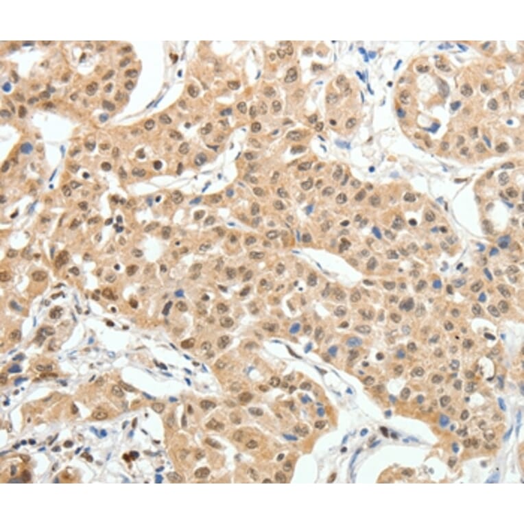 Immunohistochemistry - PAX7 Antibody from Signalway Antibody (35869) - Antibodies.com