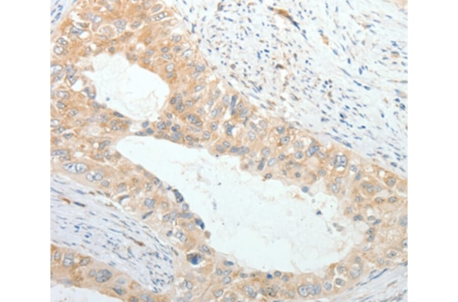 Immunohistochemistry - PRPH Antibody from Signalway Antibody (35875) - Antibodies.com