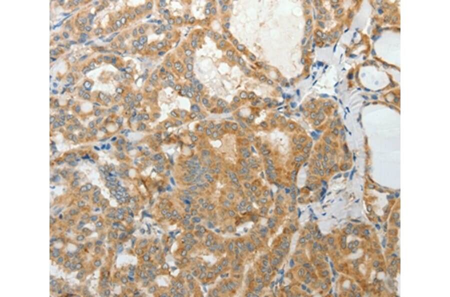 Immunohistochemistry - PRPH Antibody from Signalway Antibody (35875) - Antibodies.com