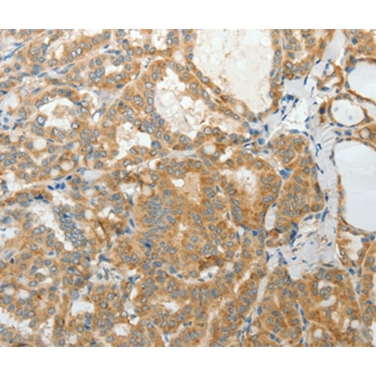 Immunohistochemistry - PRPH Antibody from Signalway Antibody (35875) - Antibodies.com