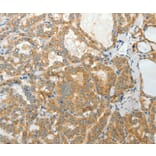 Immunohistochemistry - PRPH Antibody from Signalway Antibody (35875) - Antibodies.com