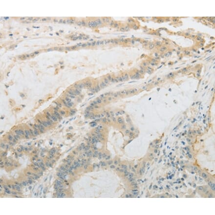 Immunohistochemistry - PLAU Antibody from Signalway Antibody (35882) - Antibodies.com