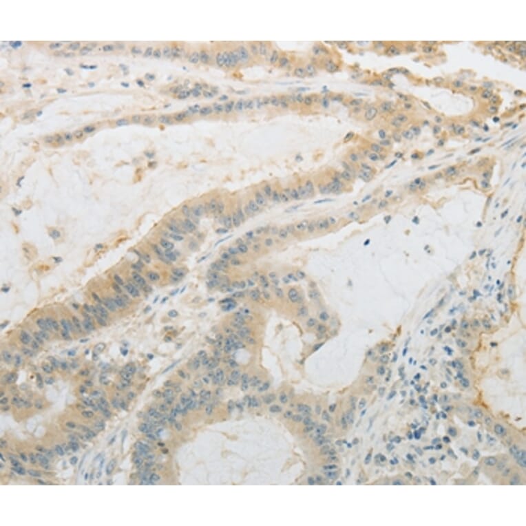 Immunohistochemistry - PLAU Antibody from Signalway Antibody (35882) - Antibodies.com