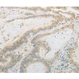 Immunohistochemistry - PLAU Antibody from Signalway Antibody (35882) - Antibodies.com
