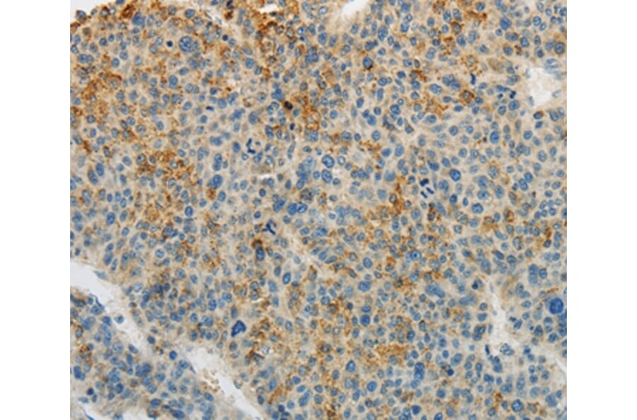Immunohistochemistry - PLAU Antibody from Signalway Antibody (35882) - Antibodies.com