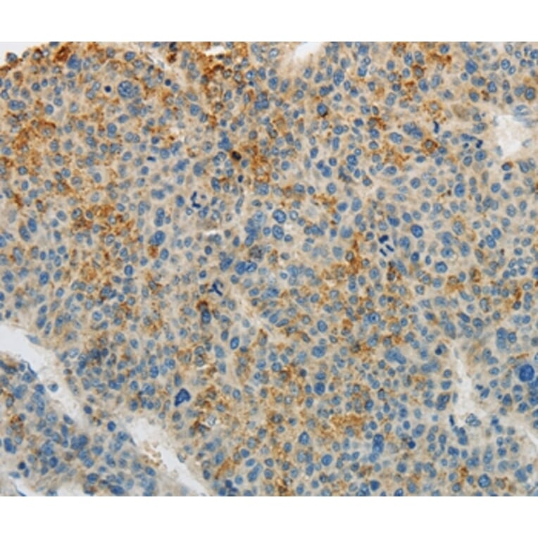 Immunohistochemistry - PLAU Antibody from Signalway Antibody (35882) - Antibodies.com