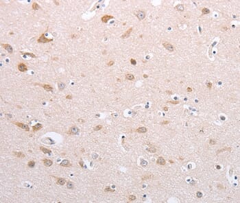 Immunohistochemical analysis of paraffin-embedded Human brain tissue using #35884 at dilution 1/20.