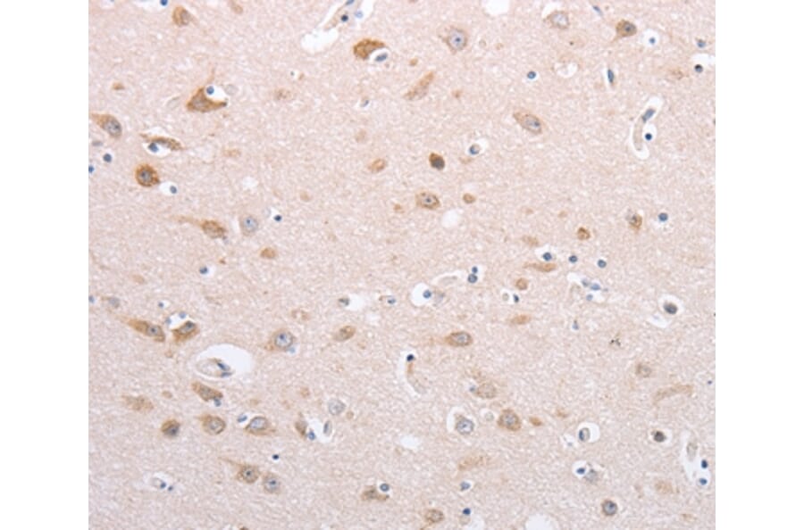 Immunohistochemistry - PFN4 Antibody from Signalway Antibody (35884) - Antibodies.com