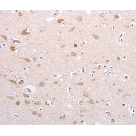 Immunohistochemistry - PFN4 Antibody from Signalway Antibody (35884) - Antibodies.com