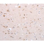 Immunohistochemistry - PFN4 Antibody from Signalway Antibody (35884) - Antibodies.com