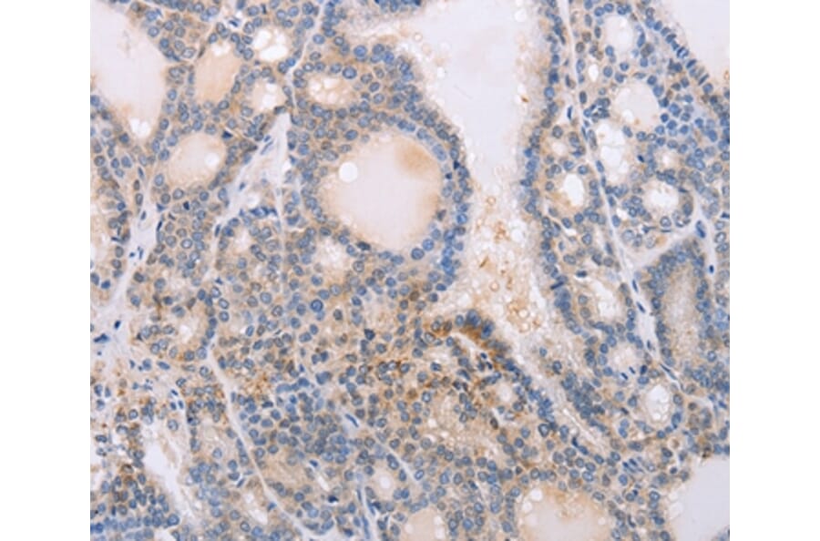 Immunohistochemistry - PFN4 Antibody from Signalway Antibody (35884) - Antibodies.com