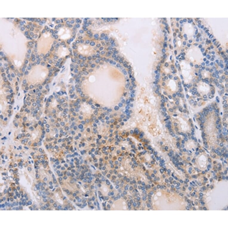 Immunohistochemistry - PFN4 Antibody from Signalway Antibody (35884) - Antibodies.com