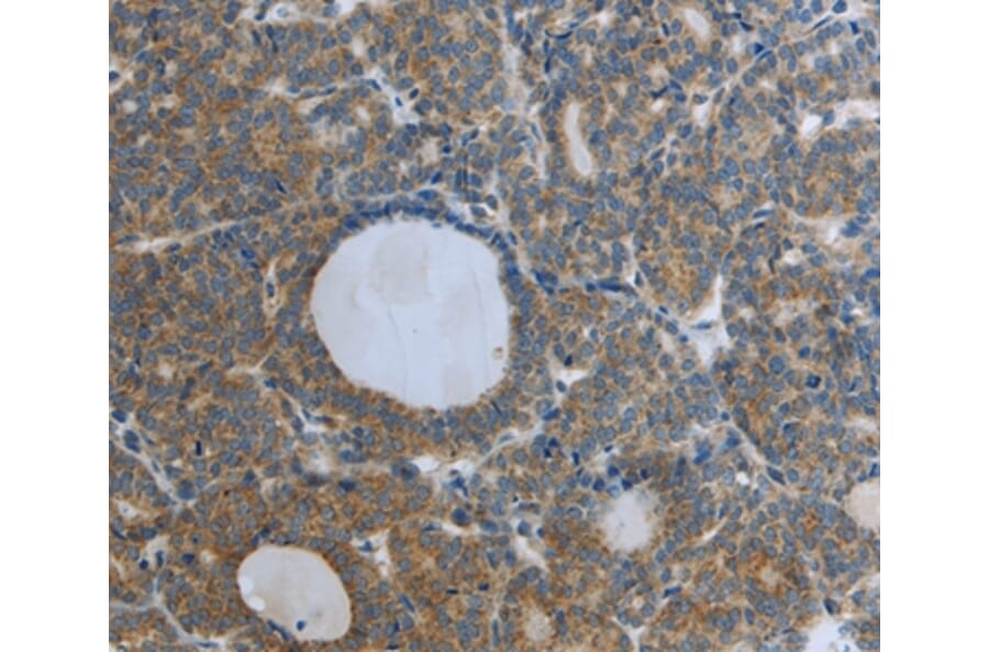 Immunohistochemistry - RETN Antibody from Signalway Antibody (35904) - Antibodies.com