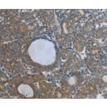 Immunohistochemistry - RETN Antibody from Signalway Antibody (35904) - Antibodies.com