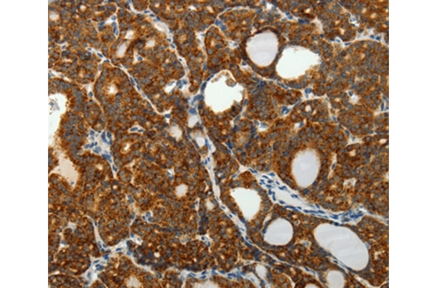 Immunohistochemistry - SELM Antibody from Signalway Antibody (35911) - Antibodies.com