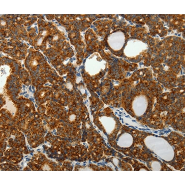 Immunohistochemistry - SELM Antibody from Signalway Antibody (35911) - Antibodies.com
