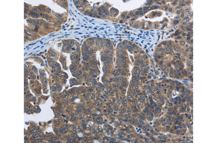 Immunohistochemistry - SYT3 Antibody from Signalway Antibody (35934) - Antibodies.com
