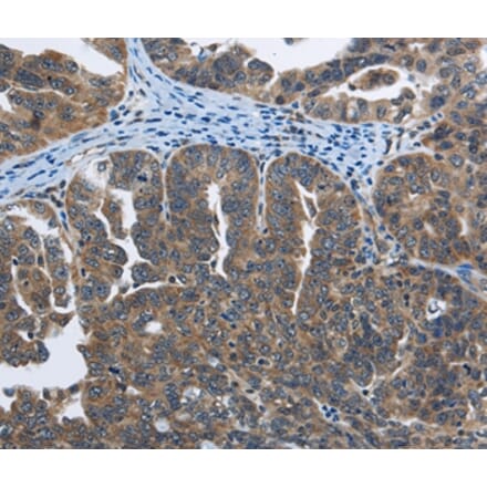 Immunohistochemistry - SYT3 Antibody from Signalway Antibody (35934) - Antibodies.com