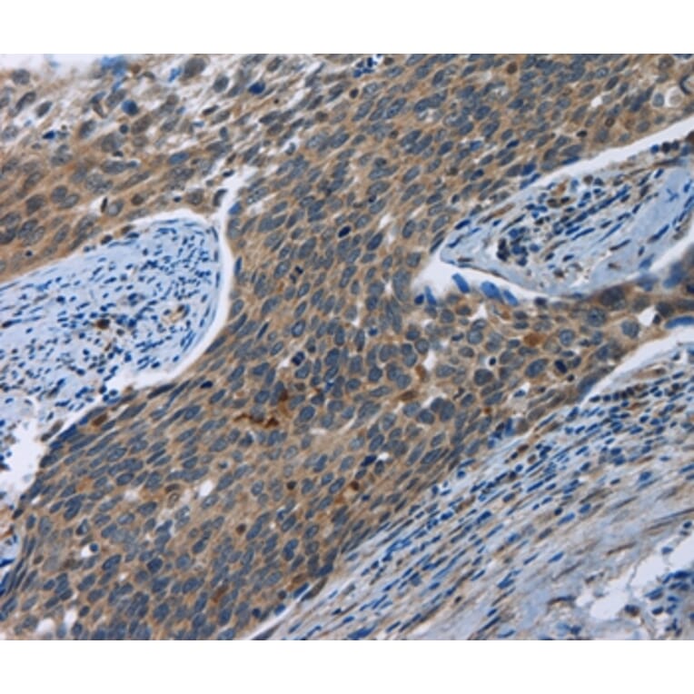 Immunohistochemistry - SYT3 Antibody from Signalway Antibody (35934) - Antibodies.com