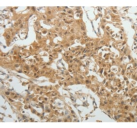 Immunohistochemistry - SYT6 Antibody from Signalway Antibody (35937) - Antibodies.com