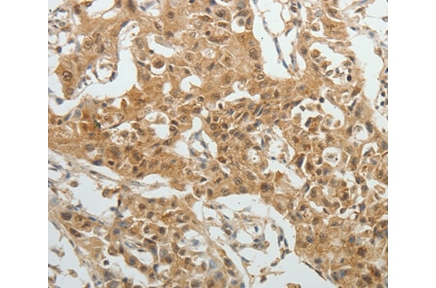 Immunohistochemistry - SYT6 Antibody from Signalway Antibody (35937) - Antibodies.com