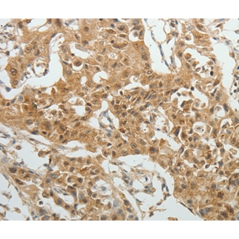 Immunohistochemistry - SYT6 Antibody from Signalway Antibody (35937) - Antibodies.com