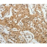Immunohistochemistry - SYT6 Antibody from Signalway Antibody (35937) - Antibodies.com