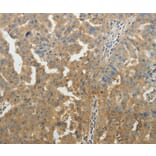 Immunohistochemistry - SYT6 Antibody from Signalway Antibody (35937) - Antibodies.com