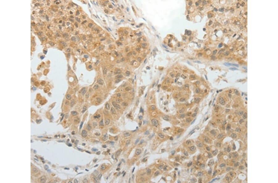 Immunohistochemistry - MAP4 Antibody from Signalway Antibody (35949) - Antibodies.com