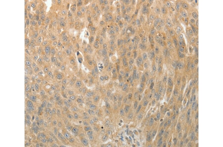 Immunohistochemistry - MAP4 Antibody from Signalway Antibody (35949) - Antibodies.com