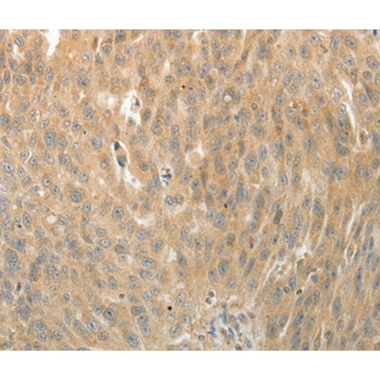 Immunohistochemistry - MAP4 Antibody from Signalway Antibody (35949) - Antibodies.com