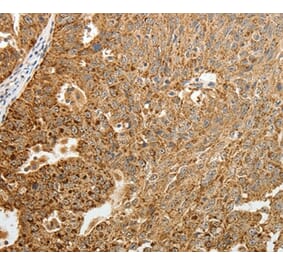 Immunohistochemistry - TFF2 Antibody from Signalway Antibody (35952) - Antibodies.com