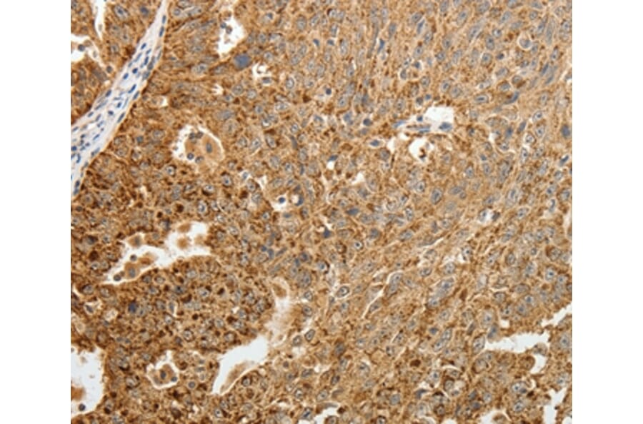 Immunohistochemistry - TFF2 Antibody from Signalway Antibody (35952) - Antibodies.com
