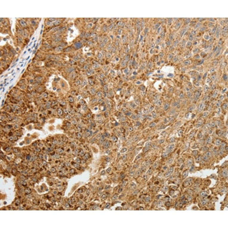 Immunohistochemistry - TFF2 Antibody from Signalway Antibody (35952) - Antibodies.com