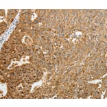 Immunohistochemistry - TFF2 Antibody from Signalway Antibody (35952) - Antibodies.com